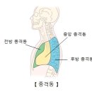 양성 종격동 종양(Benign mediastinal tumor) 이미지