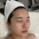 미쁘다 | 금오동피부관리 뷰티미쁘다 물방울초음파 수분진정관리 후기