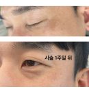 고촌약국 | [김포 고촌] 기미, 잡티 관리 받고온 후기 (피부관리, 잡티관리, 에스테틱 추천)