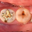 허정치과의원 이미지