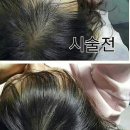 스킨앤두피