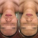 웰빙메디컬빌딩 | 피부 탄력, 승모근 고민? 윤곽 관리 답은 여기!