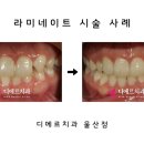 트렌디치과기공소 이미지