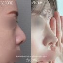 디데이성형외과의원 이미지