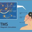 TMS