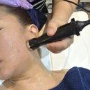 비포앤애프터 프라이빗짐 | ​사상구피부관리 [ 가꾸다뷰티 방문후기 ] 속건조 여드름 고민 1:1 맞춤 플라즈마 후 물광케어