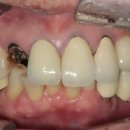 엠웍스 치과기공소 이미지