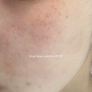 힐비뇨기과의원 이미지