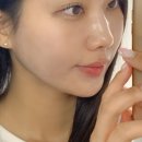 신사 이중턱시술 브이턱커스텀, 윤곽라인개선된 후기 (Feat.뷰티바성형외과)