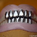 아름다운치과의원 | 서울치과 이음턱편한치과의원 아름다운 미소 완성