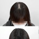 리게인프로젝트 강남본점 이미지