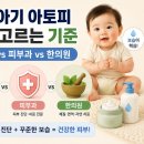올바로병원 | 우리 아기 아토피 병원 고르는 기준 | 소아과 vs 피부과 vs 한의원 장단점 및 보습제 가이드