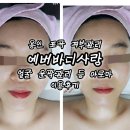 용인 포곡 피부관리 에버바디사랑 얼굴 윤곽관리 등 아로마 이용후기