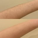 검단제일약국 | 신도시 왁싱 여기로 정착! 진짜 안 아파서 놀란 1:1 프리미엄 맞춤관리, 우리왁싱&amp;뷰티 검단점 리얼 후기