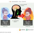 골든타임을 놓치면 안되는 갑상선 이상 증상 10가지 이미지