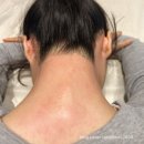 용인시 처인구 왁싱샵 “터치왁싱” 뒷목라인 후기 (슈가링왁싱)