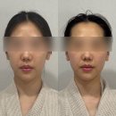 디유에스테틱 - 성남시 수정구 위례광장로 300 | 왕십리에스테틱 왕십리예신관리 디유에스테틱 이중턱관리 후기!