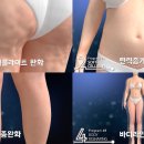 리셋의원 이미지