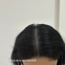 헤어인글램양산점 | 일산 탈모관리 후기｜글램유 SMP 시술 효과 & 내돈내산 리뷰