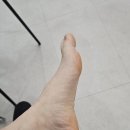 생활건강테이핑 | 족저근막염 테이핑 추천 (솔직후기)