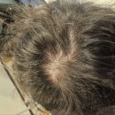 밥하는남자 | 영통두피 수원탈모관리 두피밥 수원점 | 남자친구 데려간 후기