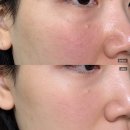 미인 | 목동 피부관리 추천 | 윤곽·트라이엄레이저·피부관리 토탈케어 후기, 미인본가 목동점