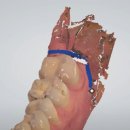 위드미치과기공소 | 비전동 위드미 치과 세미나 – 정밀한 보철물 제작을 위한 구강 스캔의 핵심 과정