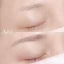 아인뷰티의원