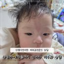 오즈피부과의원 | [챈이의 연어반이야기2]개금 오즈피부과 피부과전문의상담 신생아연어반 7개월아기연어반 연어반치료