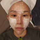 디엠타워 3관 | [방배역 힐로웨이브 앞볼 후기] 방배동 피부과에서 얼굴선 밸런스 찾기👸🏻✨