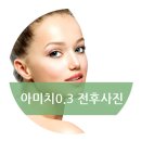 아미치0.3 네이버블로그