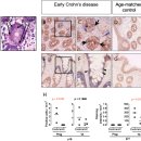 Senescent Stem and Transient Amplifying Cells in Crohn’s Disease Intestine 이미지