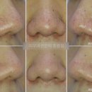 진성레이져 이미지