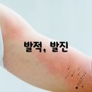 국약국 | 四字成語 총정리 734 (국소자극제~국약헌법)