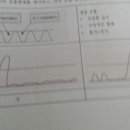 가) 와 나)중 어느것이 체인스톡 호흡? 이미지