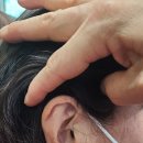 현대보청기 이미지