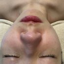 강릉 에스테틱 뷰티다룸 울트라 윤곽샷 솔직후기(주차, 요금, 비교 사진)