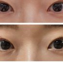 일랑뷰티왁싱&속눈썹