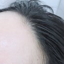 뷰티헤어라인 네이버블로그