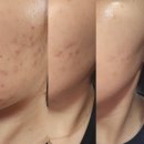 (주)뷰티벨 | 코나피딜 클렌징3종 로션 겔 폴리싱 스타터 1년사용후기