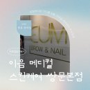 케어메디칼 | 기미잡티케어 이음메디컬스킨 후기｜출산 후 올라온 기미 관리 제대로 받았다