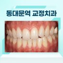 글로벌치과의원 | 동대문역 교정치과 치아교정 재교정 없는 치과 선택법