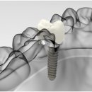 하양탑치과 이미지