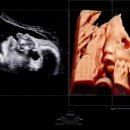 선린산후조리원 이미지