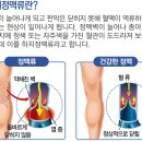 혜민외과 네이버블로그