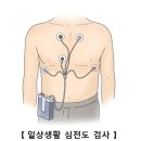 동기능 부전 증후군(Sick sinus syndrome)순환기 질환이란? 이미지