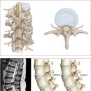 오케이참병원 앞 | 척추전문병원 추천, 후기나 규모보다 중요한 &#39;이것&#39; 확인하세요