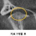 턱사랑혀사랑구강내과치과의원 네이버블로그