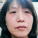 인셀덤익산중앙 | <인셀덤 익산중앙대리점> 체험 후기(3개월째 사용 중간점검)