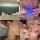 대구 달서구 피부관리 추천, 메이크뷰티스튜디오 물방울리프팅 후기